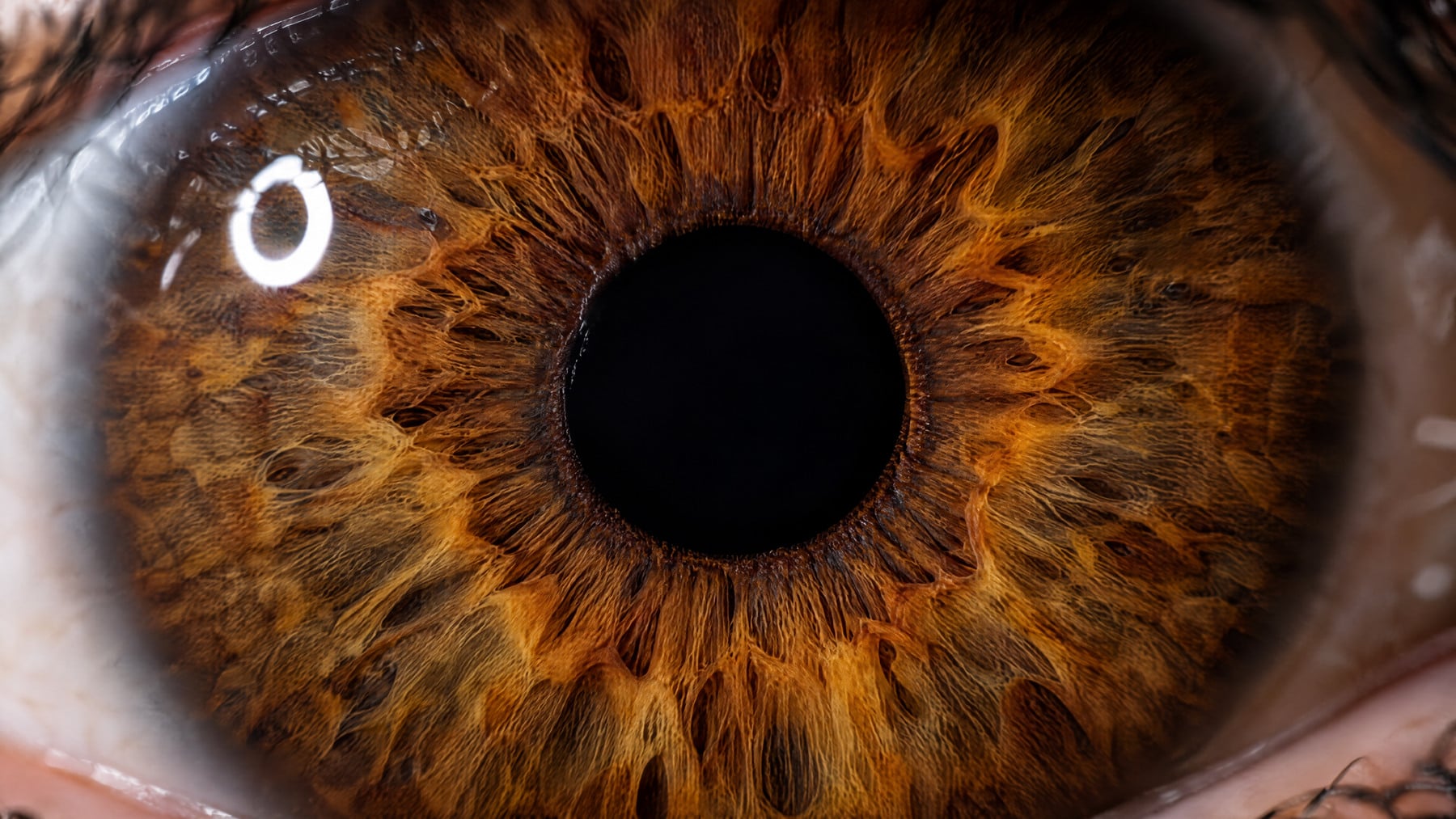 Extreme close-up of a calm brown eye with amber iris fibres and a white, unreddened sclera, accompanying an article on juvenile arthritis uveitis.